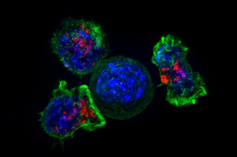 A group of killer T cells (green and red) surrounding a cancer cell (blue, center). (National Institutes of Health/Flickr)