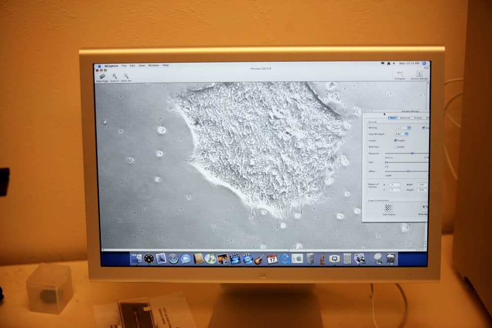 A colony of human embryonic stem cells is seen on a computer monitor that is hooked up to a microscope at the Wisconsin National Primate Research Center at University Wisconsin-Madison on March 10, 2009, in Madison, Wis. (Darren Hauck/Getty Images)