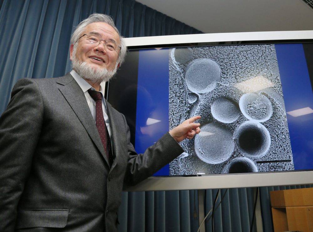 This photo taken on March 25, 2015 shows Japanese scientist Yoshinori Ohsumi speaking during a press conference at the Ministry Of Education in Tokyo. Ohsumi won the Nobel Medicine Prize for his work on autophagy -- a process whereby cells &quot;eat themselves&quot; -- which when disrupted can cause Parkinson's and diabetes. (Jiji Press/AFP/Getty Images)