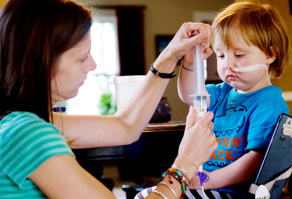 Charlie Waller, 3, helps his mother, Abigail, push a dietary supplement through a feeding tube that runs across his face and into his stomach. (Matt Radick/Flickr)