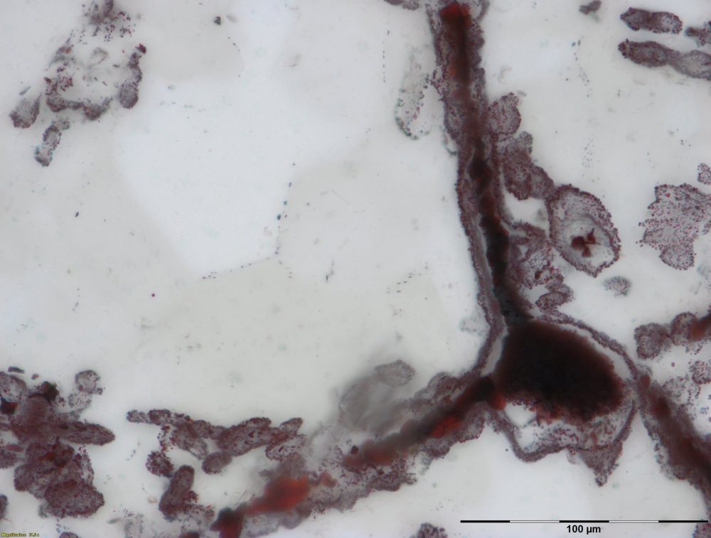 This microscope image made available by Matthew Dodd in February 2017 shows a filament attached to a clump of iron at lower right in rock found in Quebec, Canada. The structures appear to be the oldest known fossils, giving new support to some ideas about how life began, a new study says. (Matthew Dodd via AP)