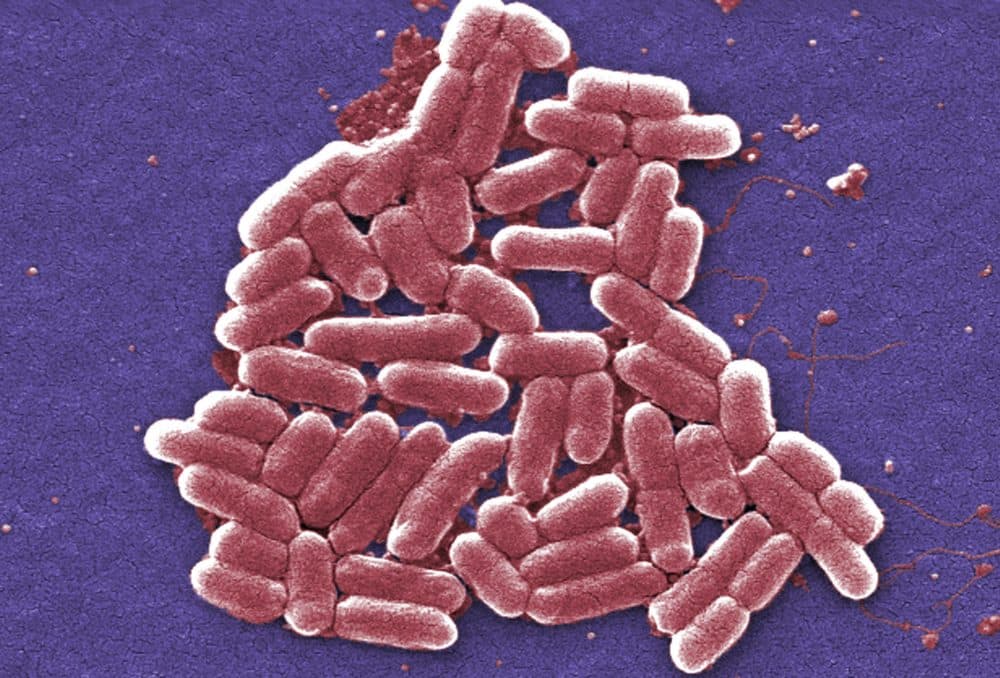 A colorized image of the O157:H7 strain of the E. coli bacteria, which can be resistant to colistin, often considered the last option in antibiotics. (Janice Carr/CDC via AP)