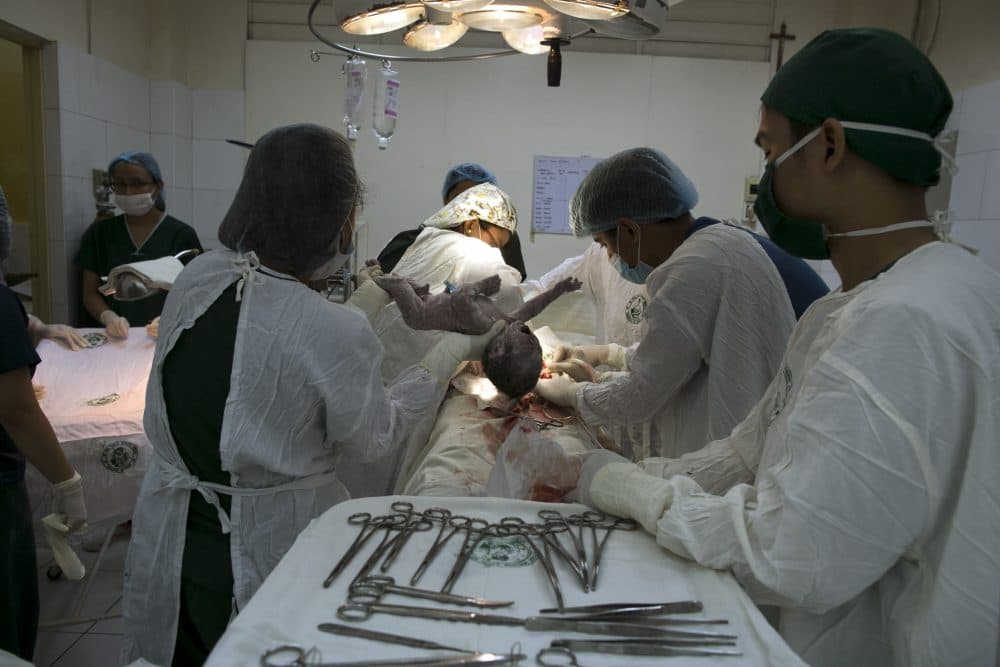 A new baby is born during a cesarean section operation in Manila, Philippines. (Paula Bronstein/Getty Images)