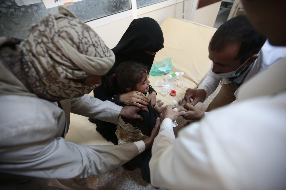 A girl is treated for a suspected cholera infection at a hospital in Sanaa, Yemen, Saturday, Jul. 1, 2017. The World Health Organization says a rapidly spreading cholera outbreak in Yemen has claimed 1,500 lives since April and is suspected of infecting 246,000 people. (Hani Mohammed/AP)