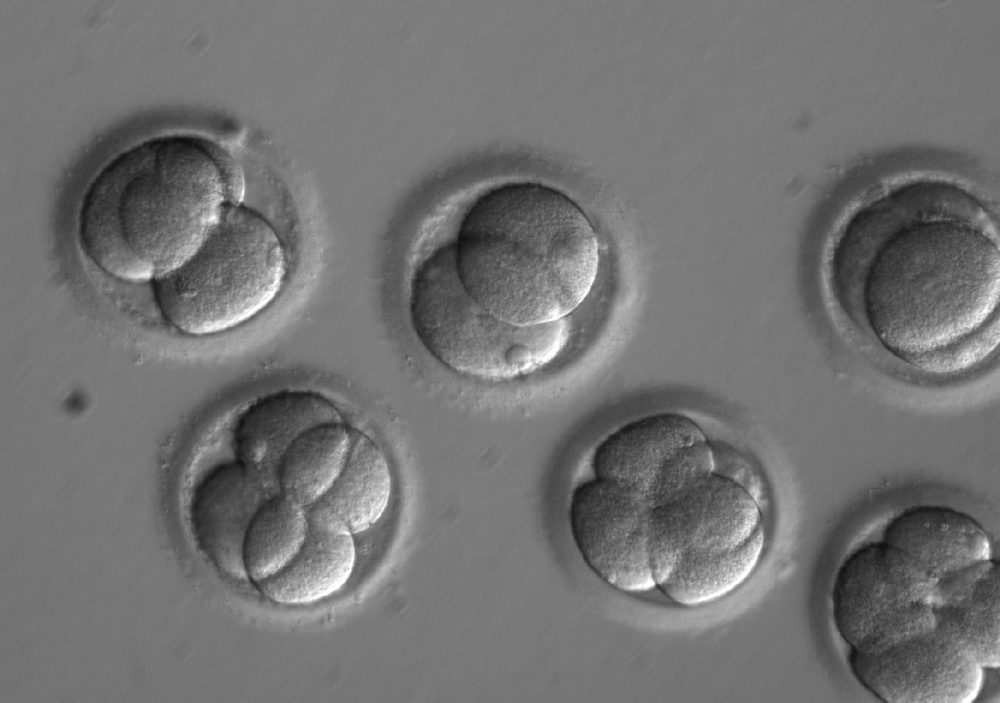 In this microscope photo provided by Oregon Health &amp; Science University, human embryos grow in a laboratory for a few days after researchers used gene editing technology to successfully repair a heart disease-causing genetic mutation. The work, a scientific first led by researchers at Oregon Health &amp; Science University, marks a step toward one day preventing babies from inheriting diseases that run in the family. (Oregon Health &amp; Science University via AP)