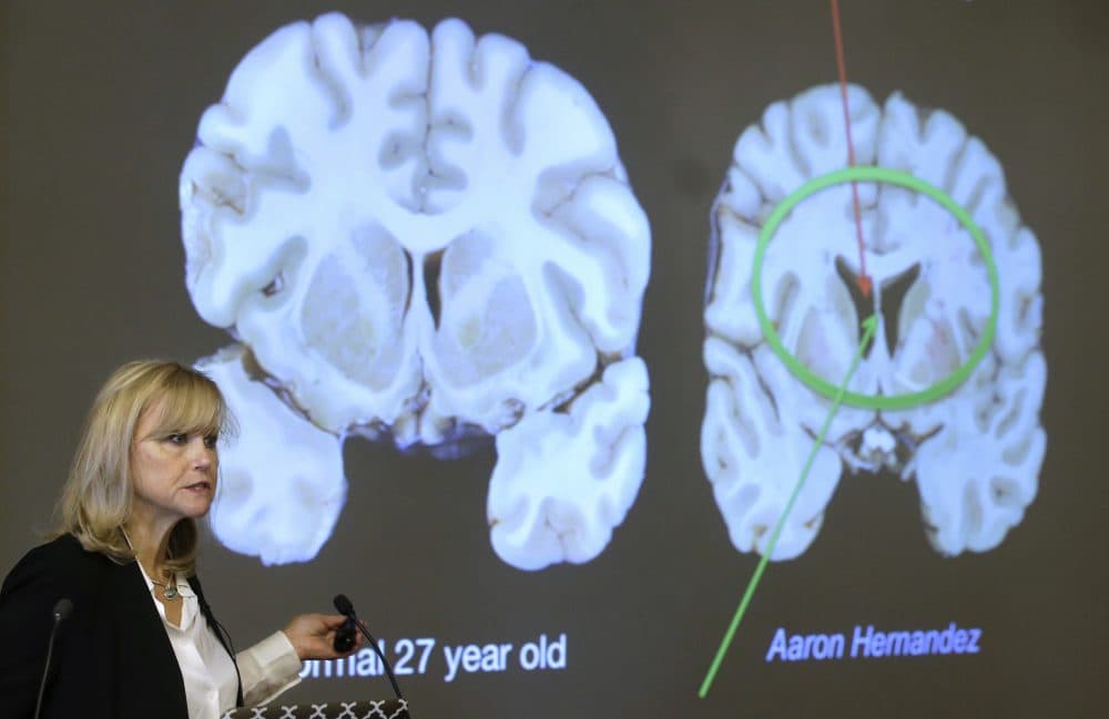Ann McKee, director Boston University's center for research into the degenerative brain disease chronic traumatic encephalopathy, or CTE, addresses an audience on the school's campus Thursday about the study of NFL football player Aaron Hernandez's brain. (Steven Senne/AP)