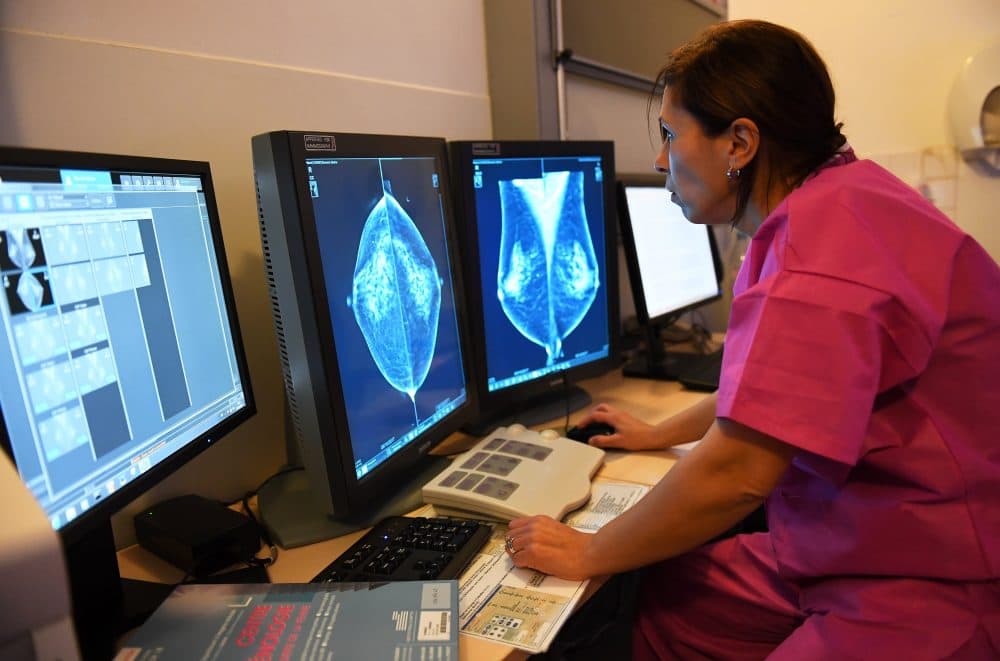 A doctor looks at the results of a breast ultrasound, on Oct. 9, 2017 at the Paoli-Calmette Institute. (Anne-Christine Poujoulat/AFP/Getty Images)