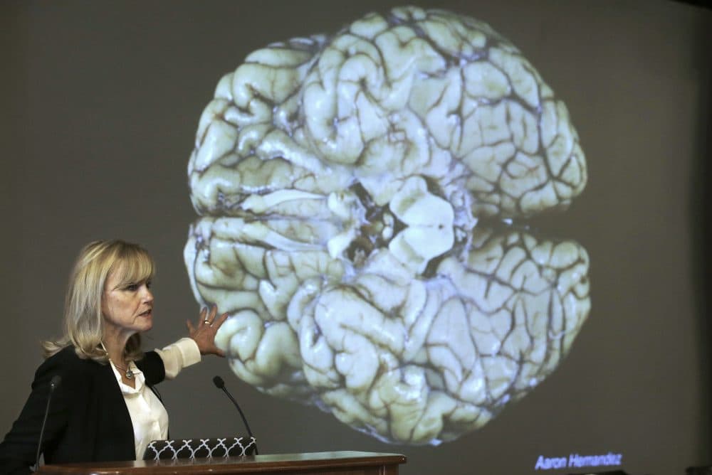 Ann McKee, director Boston University's center for research into the degenerative brain disease chronic traumatic encephalopathy speaks last November about the study of NFL football player Aaron Hernandez's brain, projected on a screen behind, in Boston. Researchers believe Hernandez suffered from CTE. (Steven Senne/AP)