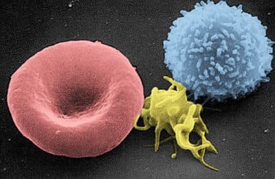 A platelet (yellow) is flanked by a red blood cell (left) and a white blood cell (right) in this electron microscope view. (WikiMedia Commons)