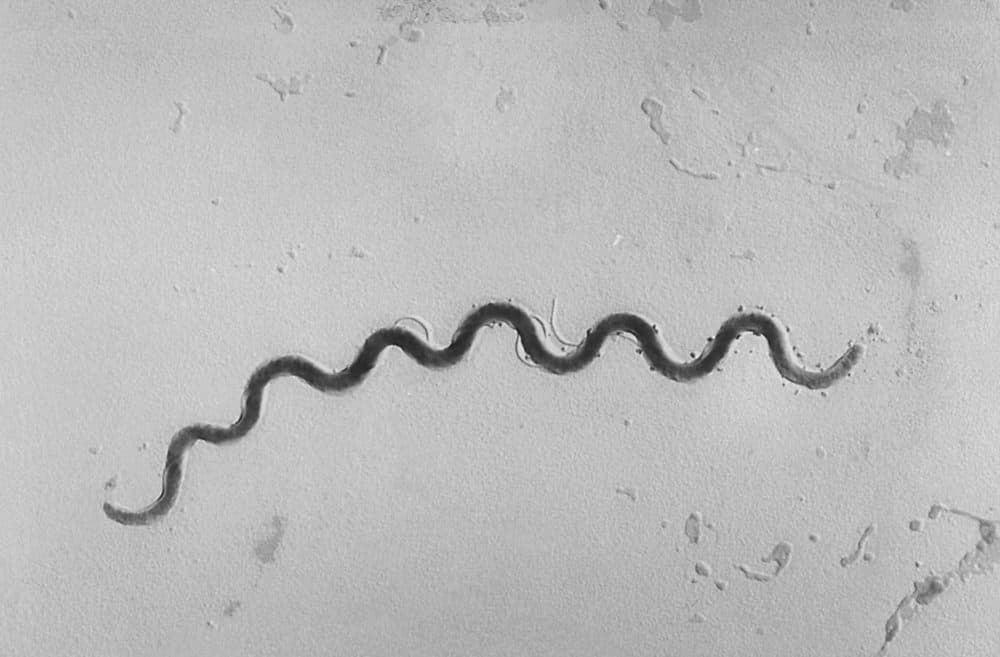 This 1972 microscope image provided by the Centers for Disease Control and Prevention shows a Treponema pallidum bacterium which causes the disease syphilis. A report released on Tuesday, Sept. 25, 2018, says that newborn syphilis infections are surging to the highest level in 20 years. (Susan Lindsley/CDC via AP)
