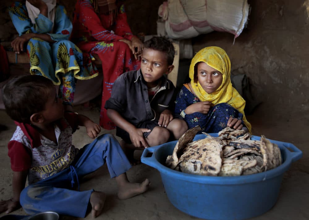 In this Oct. 1, 2018, photo, children sit in front of moldy bread in their shelter, in Aslam, Hajjah, Yemen. In a plastic washtub, the children's mother collects hard bread crumbs even those covered with mold, then mix with water, add salt, and give to her four children. (Hani Mohammed/AP)
