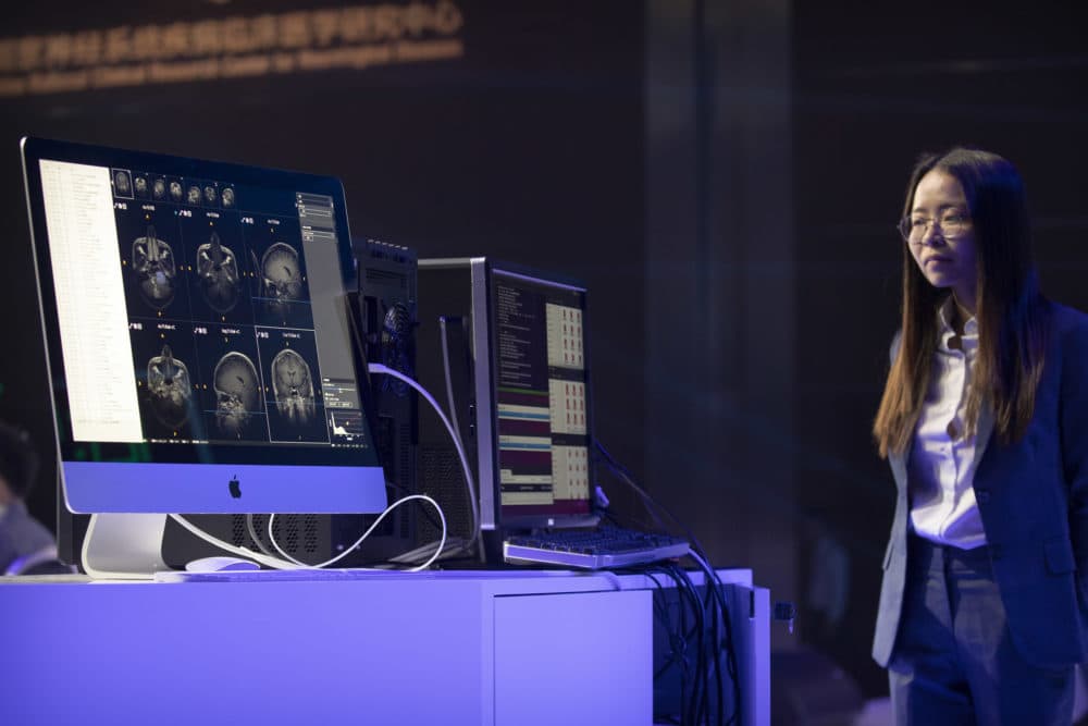 A computer running artificial intelligence software defeated two teams of human doctors in accurately recognizing maladies in magnetic resonance images during the CHAIN Cup at the China National Convention Center in Beijing in June 2018. (Mark Schiefelbein/AP)