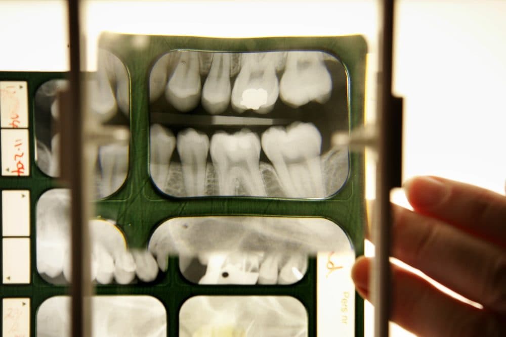Many unaccompanied migrants who claim to be under 18 years old must undergo a dental exam. (Peter Macdiarmid/Getty Images)
