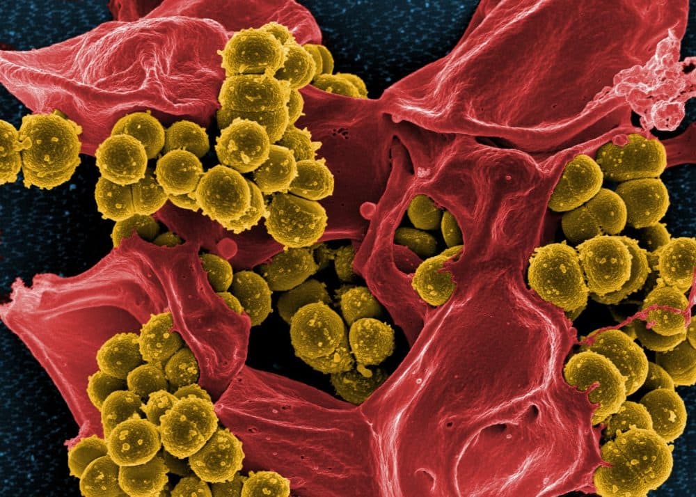 Scanning electron image of drug resistant Staphylococcus aureus bacteria (National Institute of Allergy and Infectious Diseases NIAID/NI)