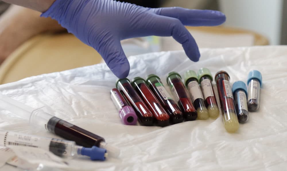 A nurse reaches for blood samples taken from a patient receiving immunotherapy. (Elaine Thompson/AP)