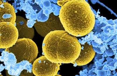 This digitally colorized microscope image provided by the National Institute of Allergy and Infectious Diseases shows Staphylococcus aureus bacteria in yellow. (National Institute of Allergy and Infectious Diseases via AP)