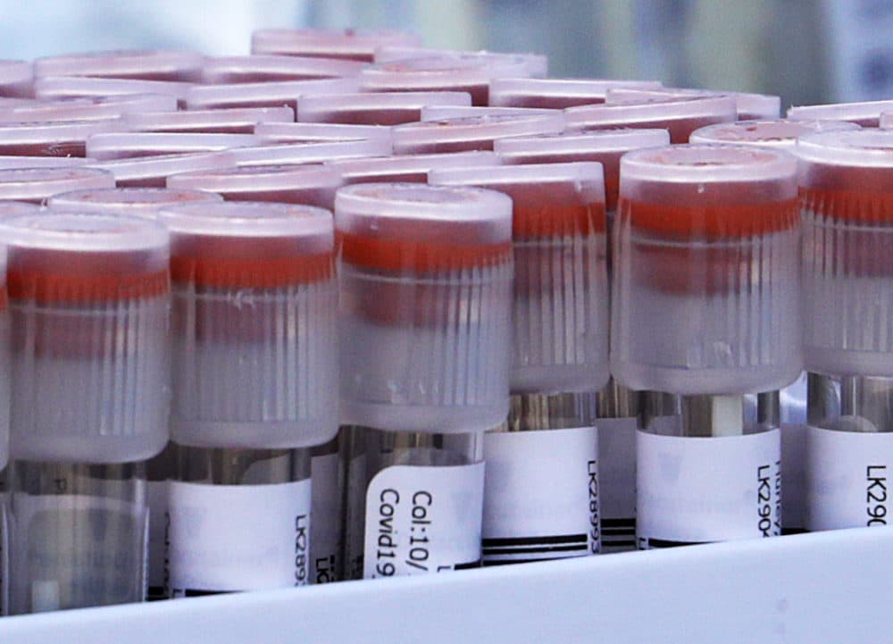 Test tubes hold tested swabs at an Aveanna Healthcare and Fallon Ambulance walk-up COVID-19 testing site in Lynn on Oct. 19, 2020. (Pat Greenhouse/The Boston Globe via Getty Images)