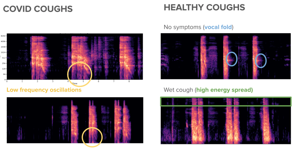 Images from researchers at Cambridge University show how algorithms look for signs of COVID-19 in audio samples of coughs. (Courtesy of Dimitris Spathis)