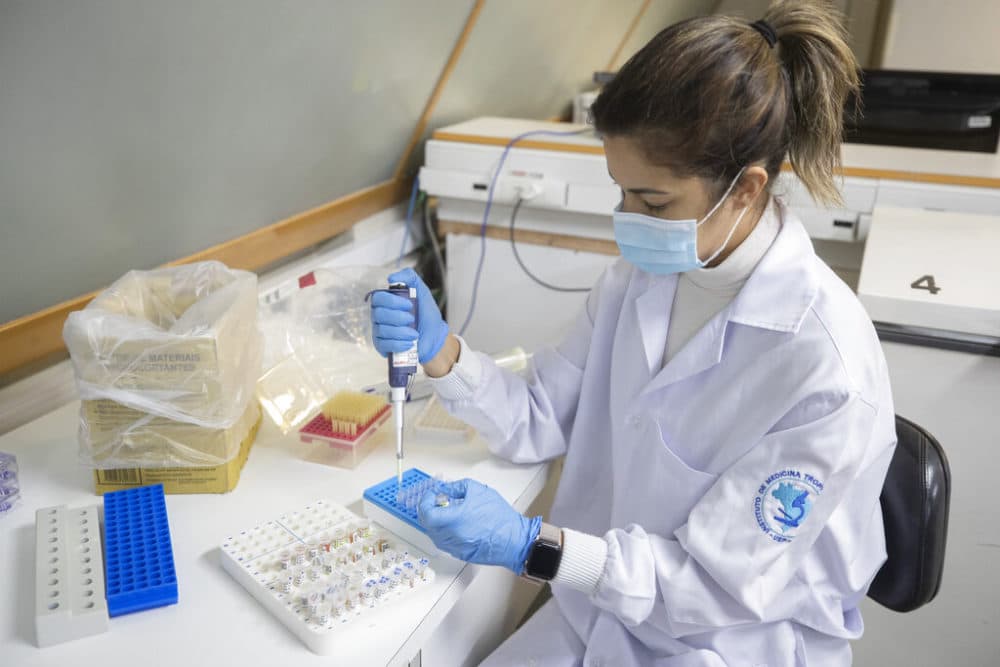 A Tropical Medicine University virology lab researcher works to develop a test that will detect the P.1 variant of the new coronavirus, in Sao Paulo, Brazil, March 4, 2021. The variant, which was first found in Manaus, Brazil, appears to be more contagious than other COVID-19 strains. (Andre Penner/AP)