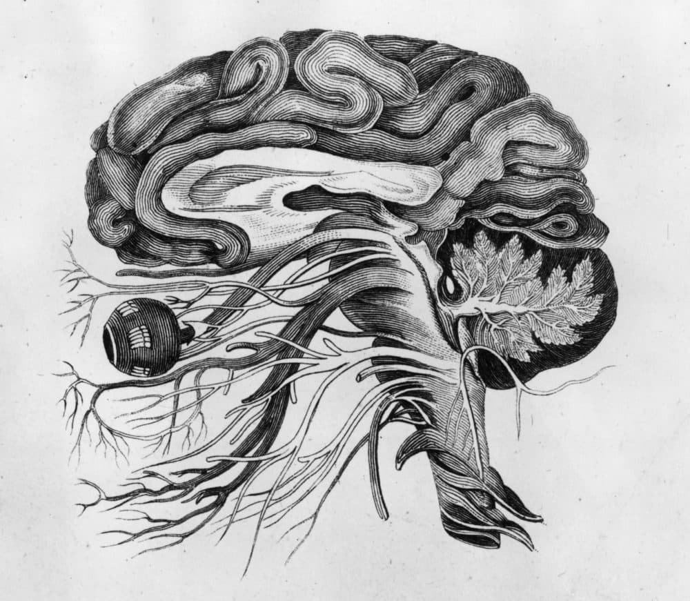 Anatomical drawing of the human brain and cerebral nerves. (Hulton Archive/Getty Images)
