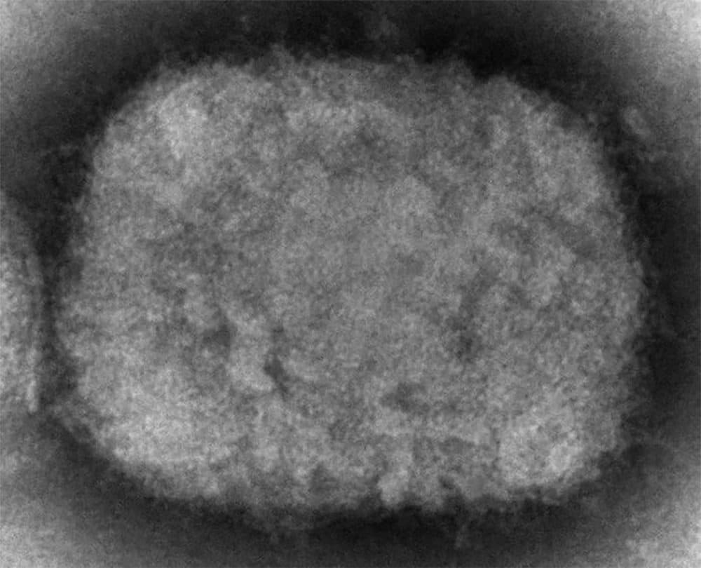 This 2003 electron microscope image made available by the Centers for Disease Control and Prevention shows a monkeypox virion, obtained from a sample associated with the 2003 prairie dog outbreak. (Cynthia S. Goldsmith, Russell Regner/CDC via AP)