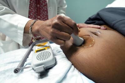 A doctor uses a hand-held Doppler probe on a pregnant woman to measure the heartbeat of the fetus. (Rogelio V. Solis/AP)