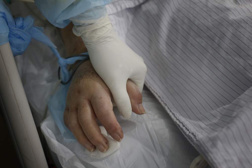 A nurse holds the hand of a patient in the intensive care unit. (Jorge Saenz/AP)