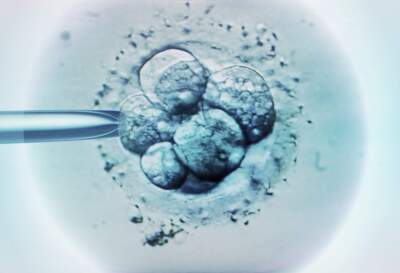 Embryo selection for IVF, light micrograph. ( Science Photo Library - ZEPHYR via Getty Images)