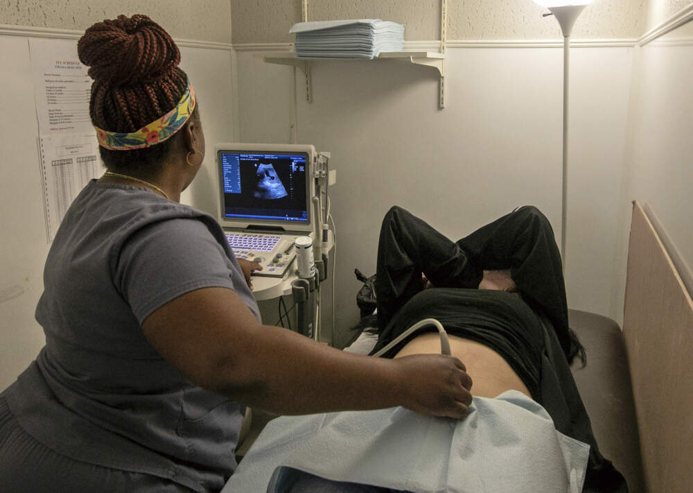 Operating room technician Nikki Jordan performs an ultrasound on a patient at Hope Medical Group for Women in Shreveport, Louisiana. (Ted Jackson/AP)