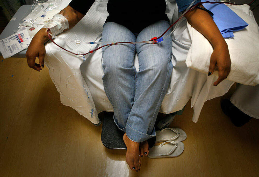 Marguerita, an undocumented citizen from Mexico, is connected to a dialysis machine at the St. Joseph Hospital Renal Center in Orange, Calif., where she receives dialysis three times a week. (Mark Boster/Getty Images)